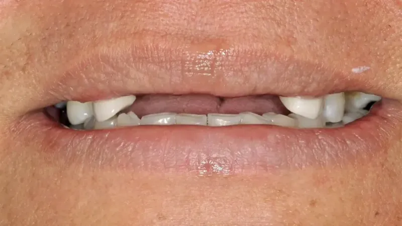 smile makeover before 7