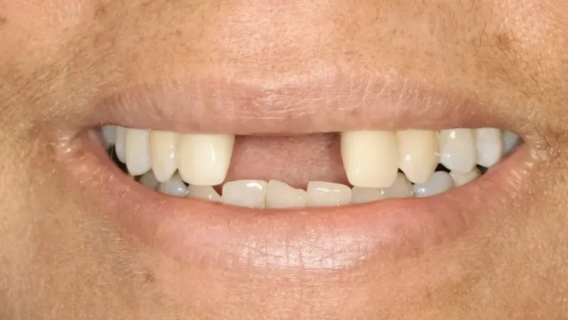 smile makeover before 8